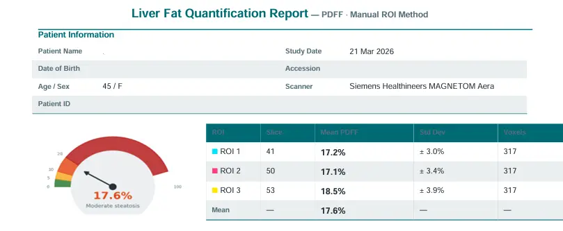 Sample PDFF liver fat report showing colour map and fat fraction percentage